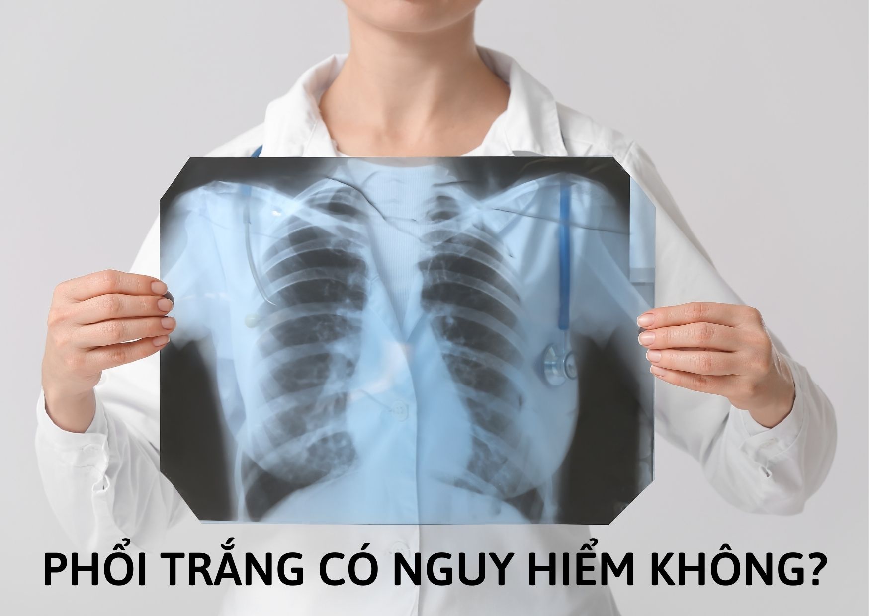 Phổi trắng thường gặp trong những bệnh lý nào? Bệnh có nguy hiểm không?