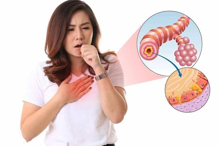 Co thắt phế quản khó thở nguyên nhân do đâu và phương pháp điều trị hiệu quả